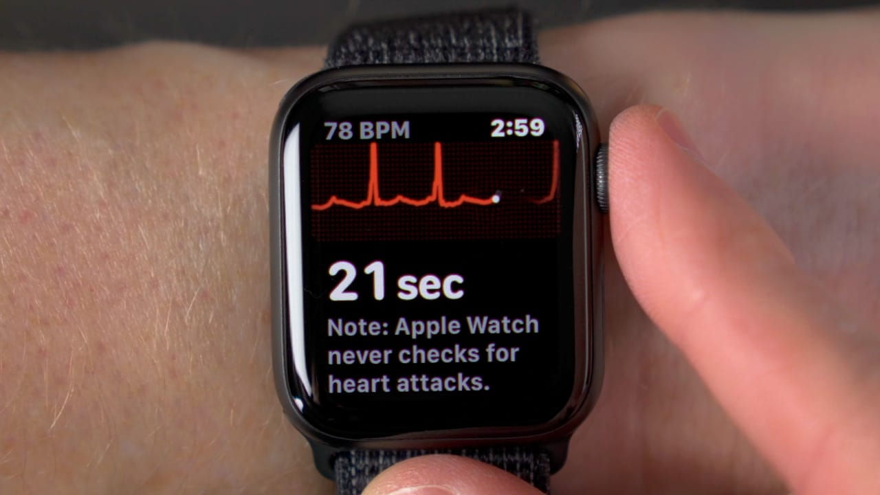 Apple Watch Series 5 - the future of wearable technology in healthcare