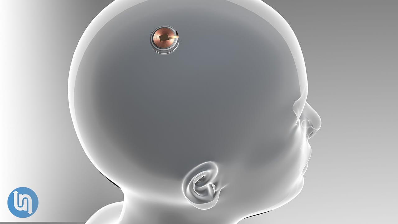 The Future of Neuralink - Where Will it Take Humanity?